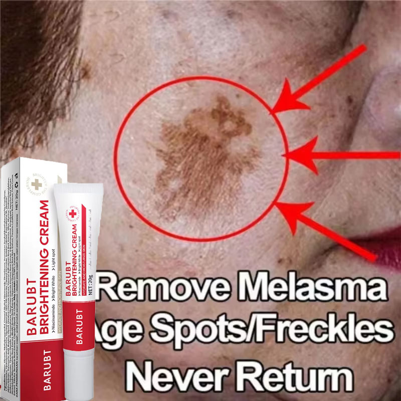 Charcoal Whitening Paste - Powerful Spot-removing Whitening Cream Brighten Skin