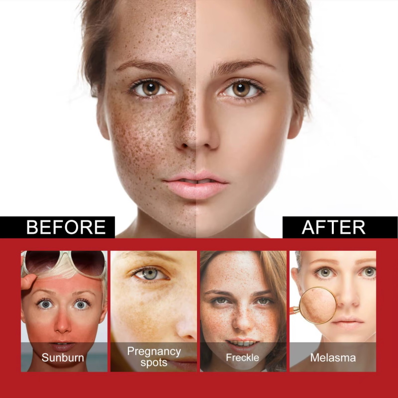 Powerful Spot-Removing Whiten  - Charcoal Whitening Paste review and price