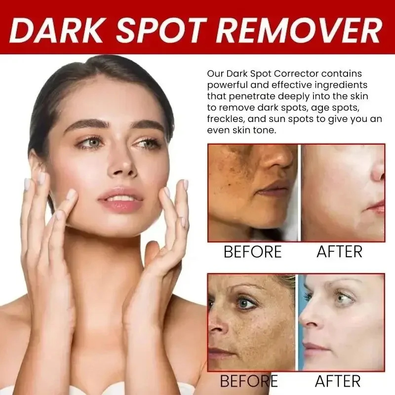 Powerful Spot-Removing Whiten  - Charcoal Whitening Paste review and price