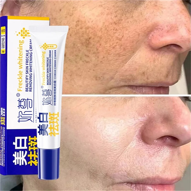 Powerful Spot-Removing Whiten  - Charcoal Whitening Paste review and price