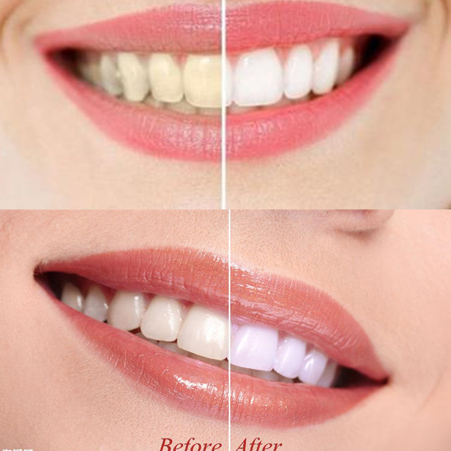 Bamboo Charcoal Teeth Tooth De - Teeth Whitening Zimba review and price