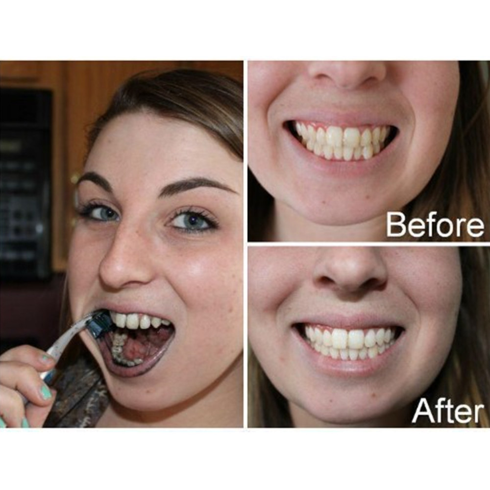 Bamboo Charcoal Teeth Tooth De - Teeth Whitening Zimba review and price