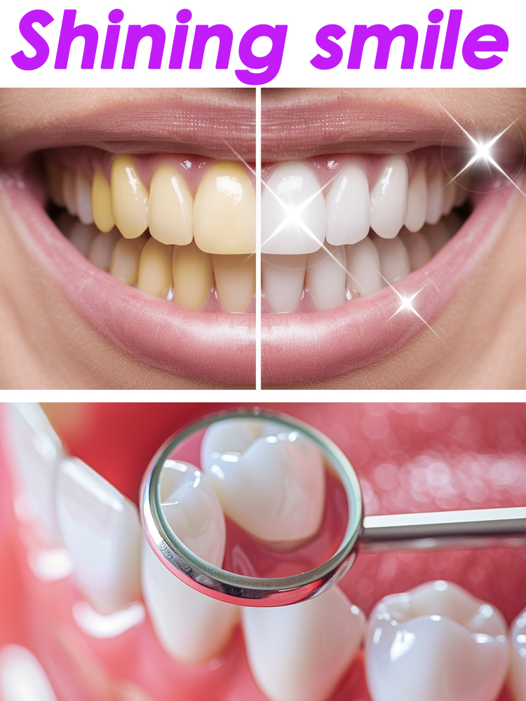 GlorySmile Teeth Whitening Fru - Teeth Whitening Xylitol review and price