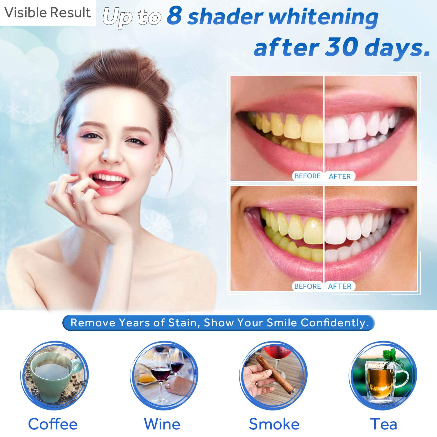 Teeth Whitening Gel Refill Syr - Teeth Whitening Gel Peroxide review and price