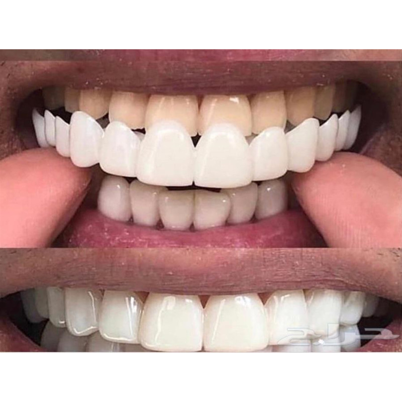 Soft Silicone Gel Dental Oral  - Teeth Whitening Moulds review and price