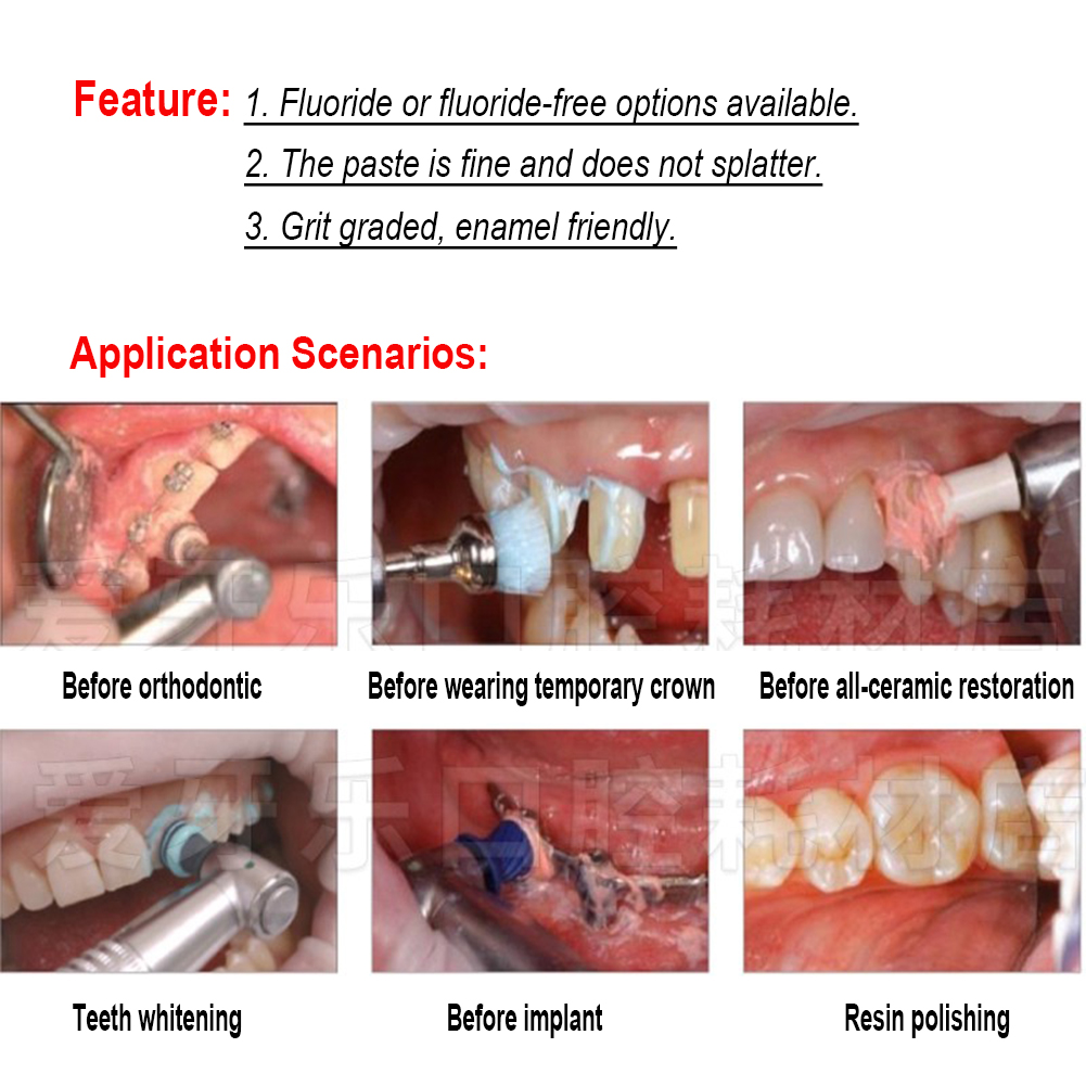 Ivoclar Vivadent Oral Teeth Po - Teeth Whitening Xylitol review and price