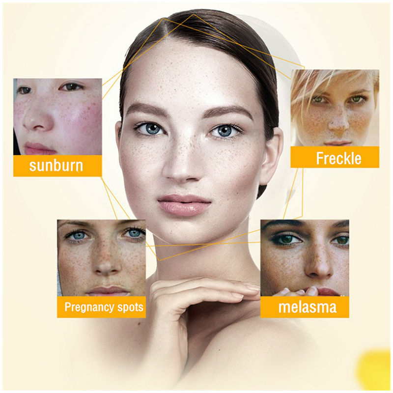 Dimollaure Whitening Freckle C - Charcoal Whitening Paste review and price