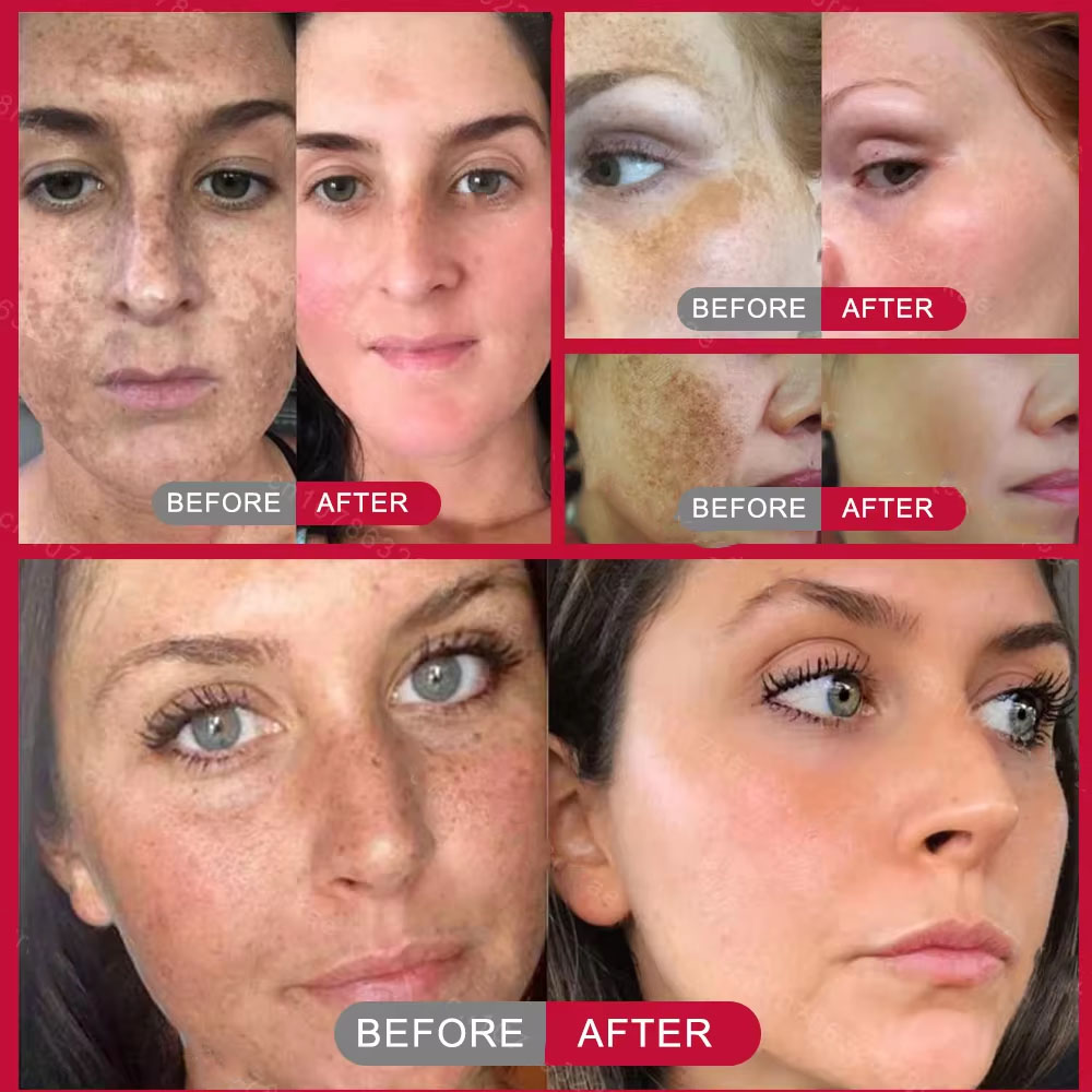 Powerful Spot-removing Whiteni - Charcoal Whitening Paste review and price