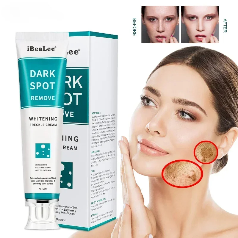 Whitening Freckle Cream Remove - Charcoal Whitening Paste review and price