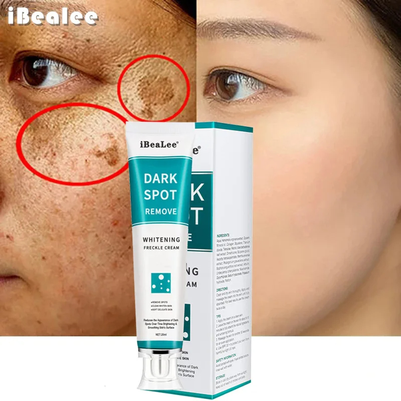 Whitening Freckle Cream Remove - Charcoal Whitening Paste review and price