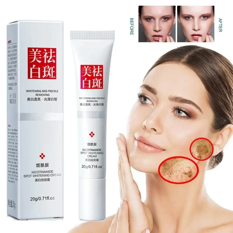 Fades Freckle Dark Spots Face  - Charcoal Whitening Paste review and price