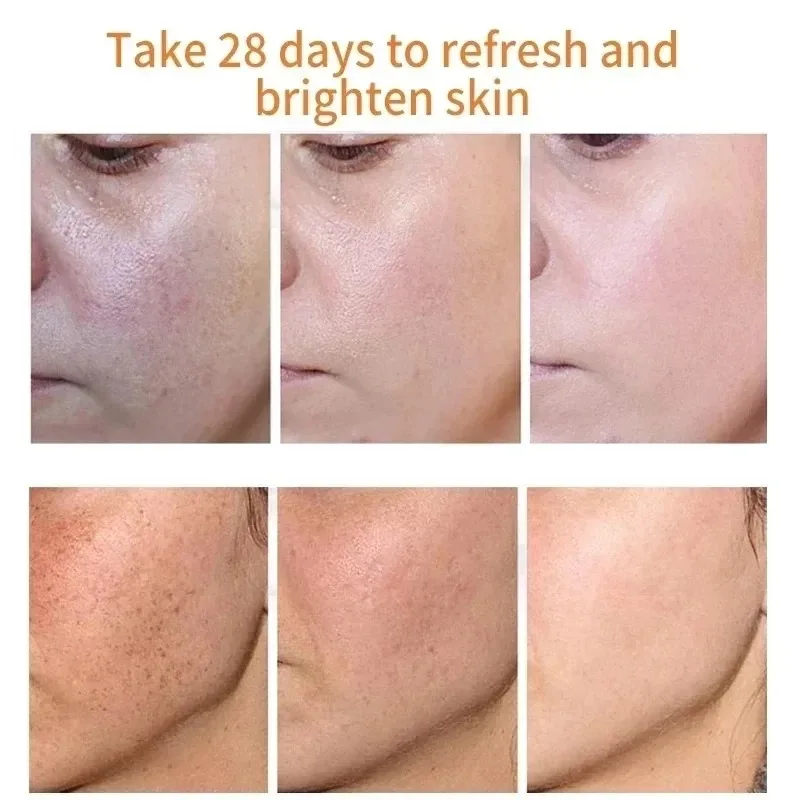 Fades Freckle Dark Spots Face  - Charcoal Whitening Paste review and price