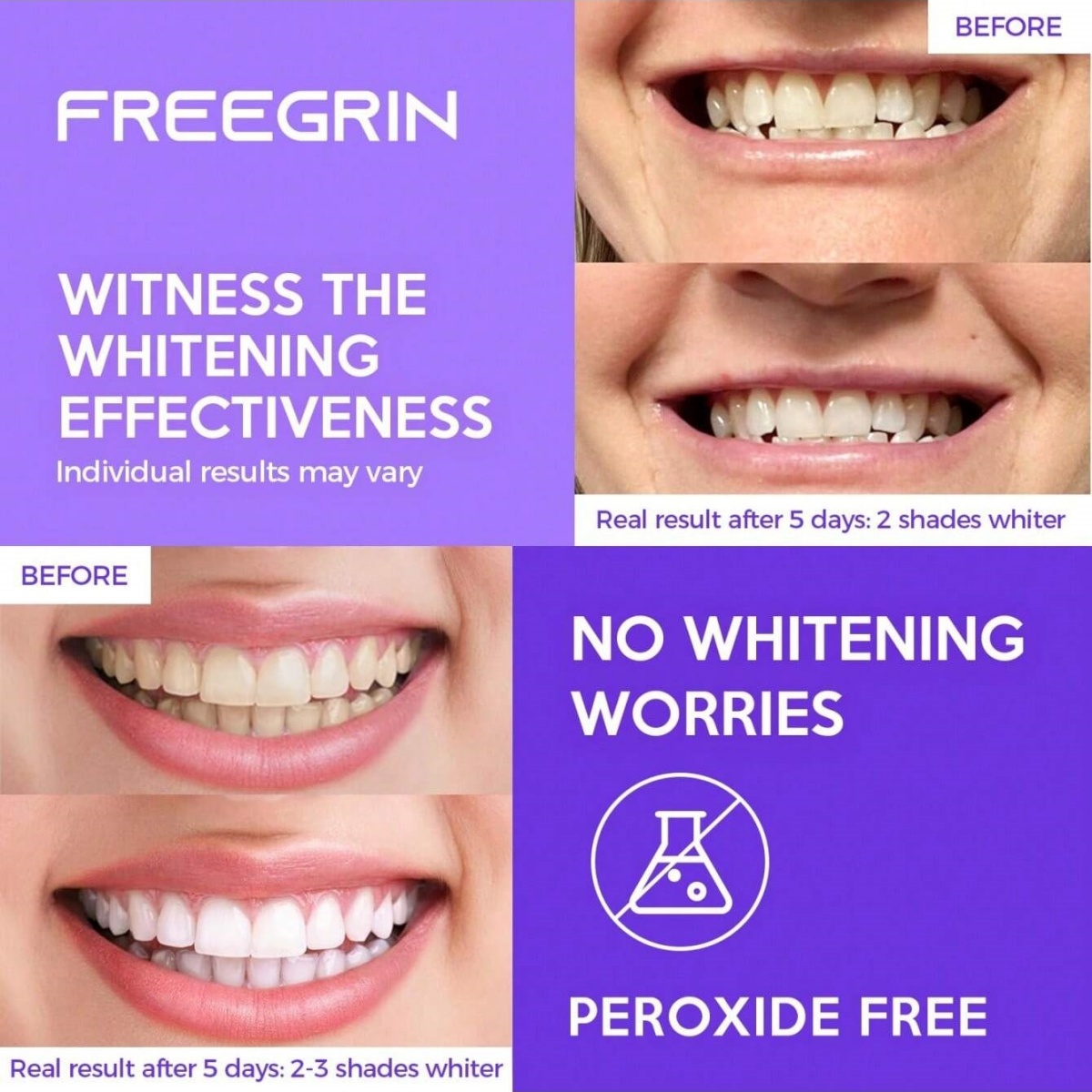 Deluxe Whitening Teeth Sticker - Teeth Whitening Gel Peroxide review and price